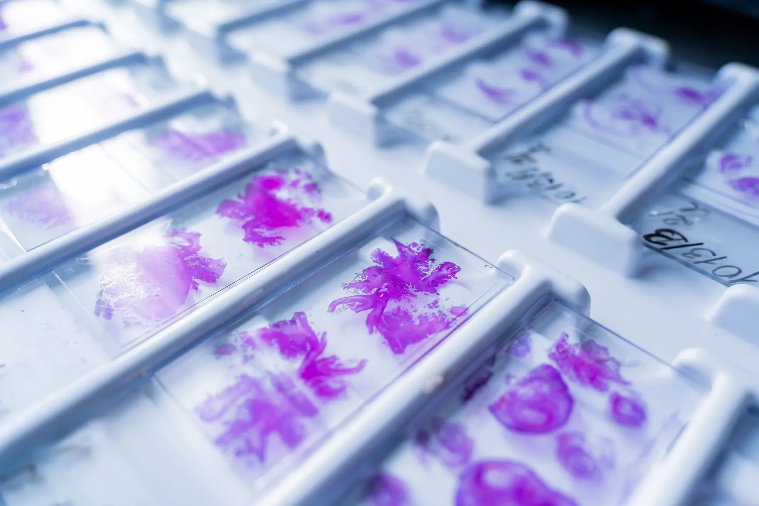 Full Lifecycle Software Development of IHC Slide Staining Instrument